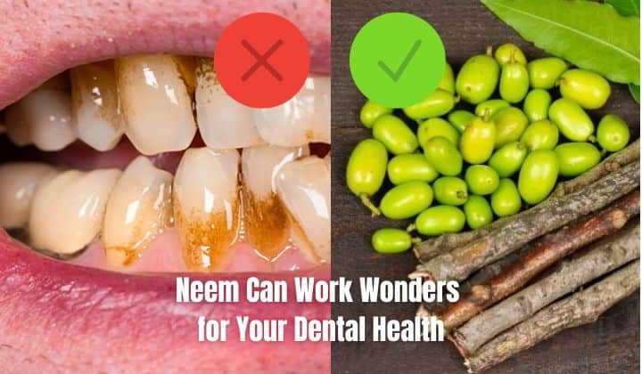 Neem Can Work Wonders for Your Dental Health