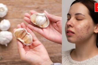 Does Eating Garlic Help with Acne?